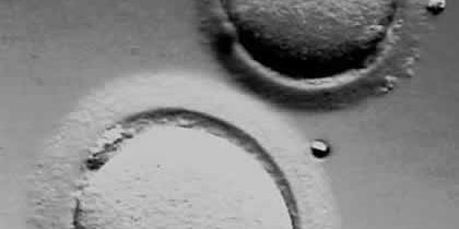 Κατάψυξη Ωαρίων Κατάψυξη Ωαρίων -Τελικά λειτρουργεί!