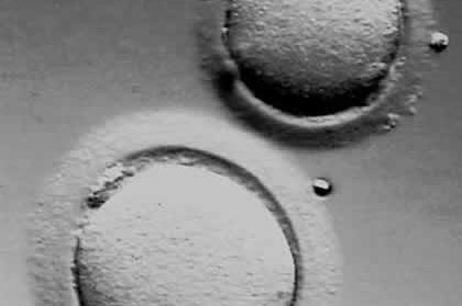 Κατάψυξη Ωαρίων -Τελικά λειτρουργεί!