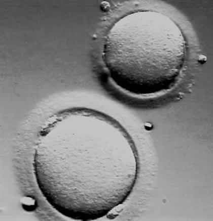 Κατάψυξη Ωαρίων Κατάψυξη Ωαρίων -Τελικά λειτρουργεί!