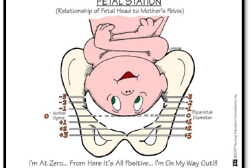 Πόσο ψηλά ή χαμηλά είναι το μωρό στην λεκάνη σας και τι σημαίνει αυτό για τον τοκετό σας; Η μαία μας Γεωργία Λεζέ σας εξηγεί τα πάντα για την εμπέδωση!