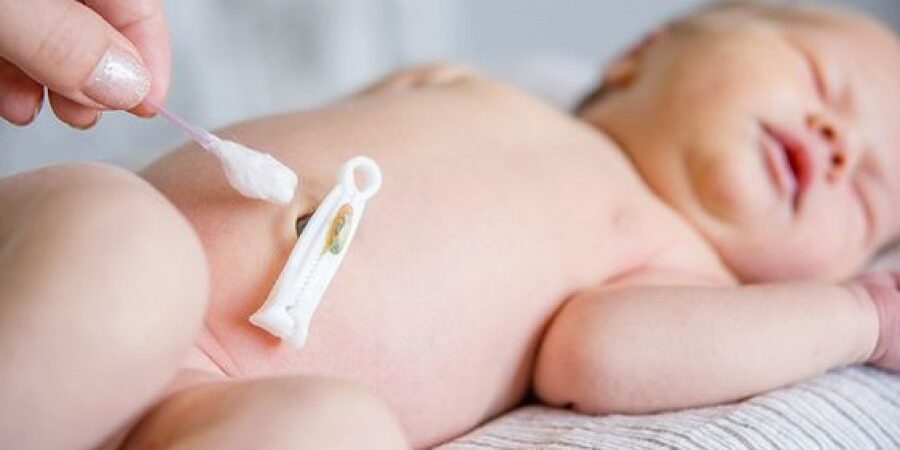 4574050533b8ea8ae703ffdf4259c2ce_XL Ο ομφάλιος λώρος για τις πρώτες ημέρες ή εβδομάδες μετά την γέννηση ανησυχεί αρκετούς νέους γονείς σχετικά με τις ανάγκες της φροντίδας του.