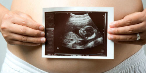 bump_scan To υπερηχογράφημα Β’ επιπέδου είναι ένα από τα δύο πιο σημαντικά υπερηχογραφήματα κατά τη διάρκεια της κύησης μαζί με την αυχενική διαφάνεια.